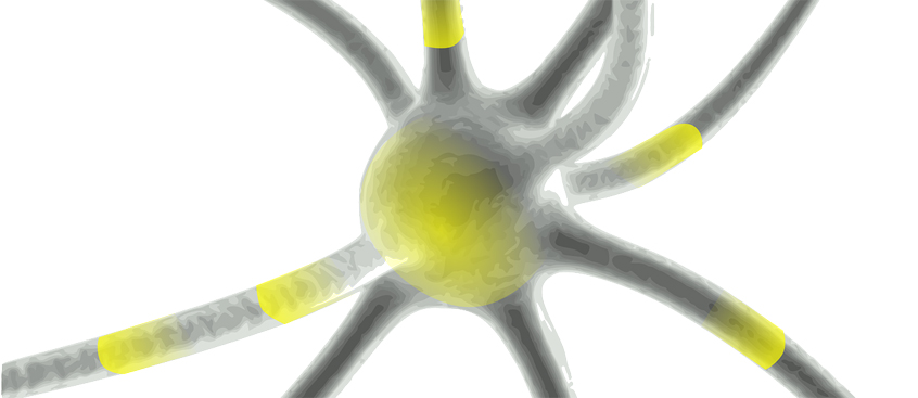 La Esclerosis Múltiple puede ser ralentizada o detenida a través de una proteína
