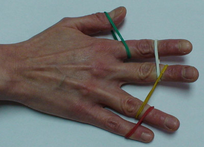 Ejercicios para trabajar la movilidad de la mano retracciones - Esclerosis información y tratamiento