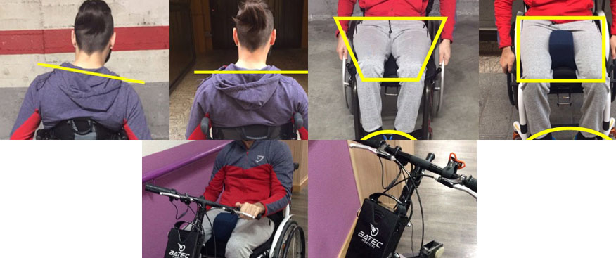 en terapia ocupacional se entrenan los puntos de apoyo